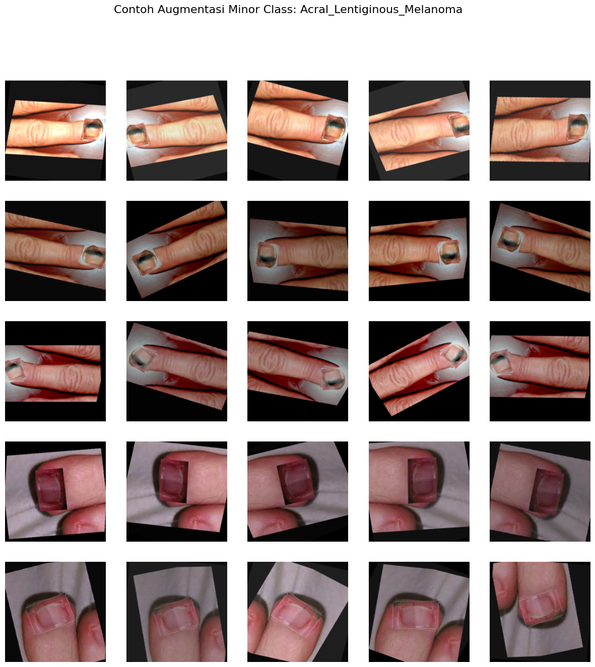 Nail disease classification augmentation samples